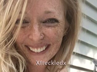 Xfreckledx